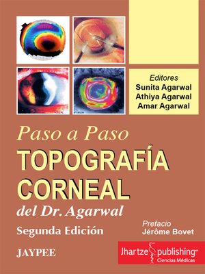 cover image of TOPOGRAFÍA CORNEAL